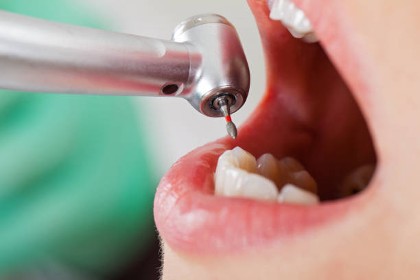 Best Walk-In Emergency Dentist in Cambridge City, IN